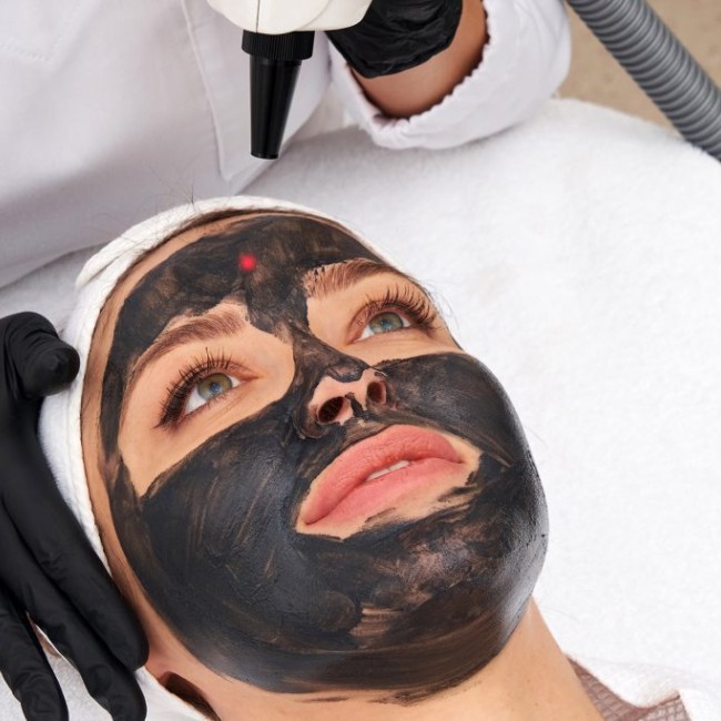 Peel Carbon Laser - Traitement de visage et corps