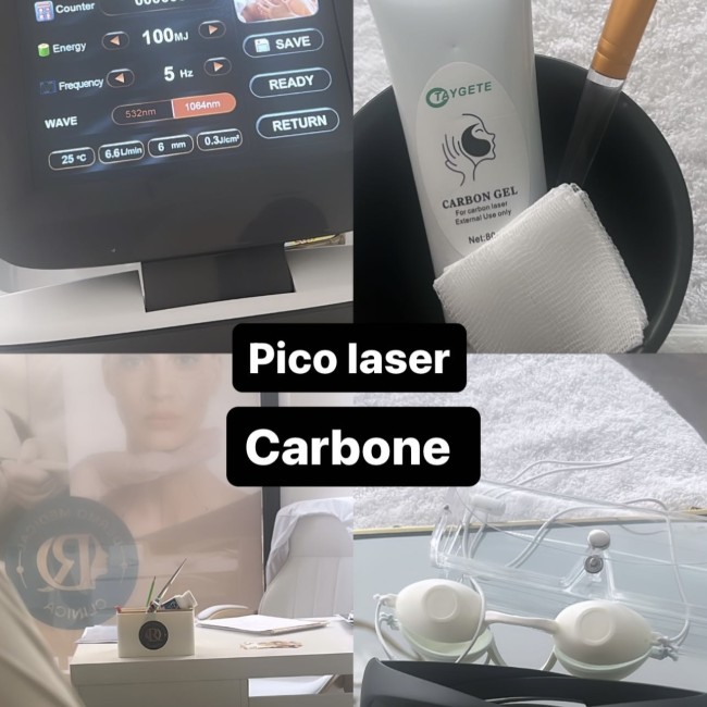 Peel Carbon Laser - Traitement de visage et corps